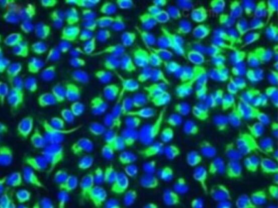 Acc-2（人涎腺腺样囊性癌细胞）