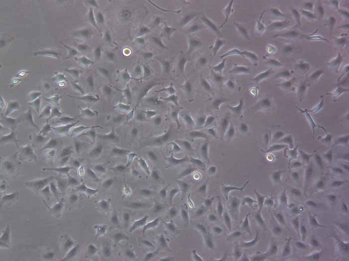 A549 [A-549]（人非小细胞肺癌细胞） (STR鉴定正确)