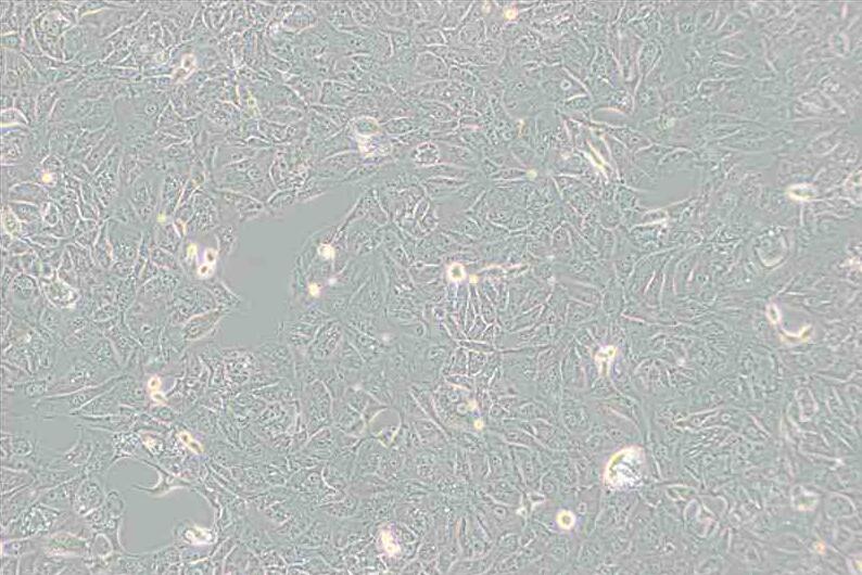 769-P（人肾细胞腺癌细胞）(STR鉴定正确)