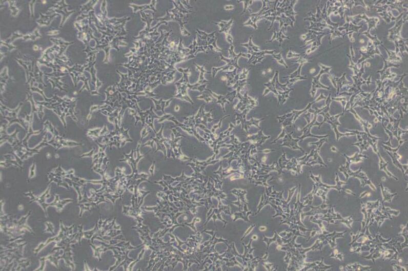 22RV1（人前列腺癌细胞）