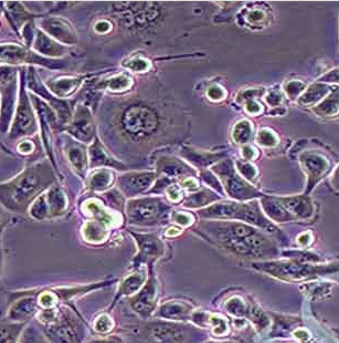 ACHN（人肾细胞腺癌细胞）