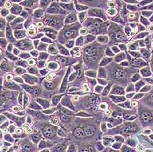 AGS人胃腺癌细胞（STR鉴定正确）