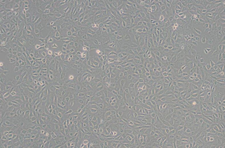 ARPE-19/HPV-16（人视网膜上皮细胞）