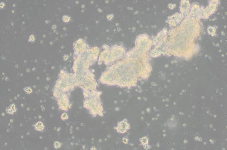 AtT-20（小鼠垂体瘤细胞）