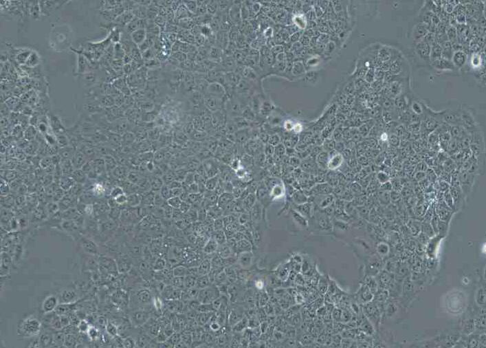 Ca Ski (人宫颈癌肠转移细胞/人宫颈癌上皮细胞)