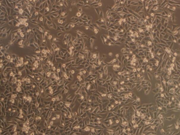 CaES-17（人食管癌细胞）