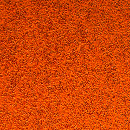 E0771小鼠乳腺癌细胞