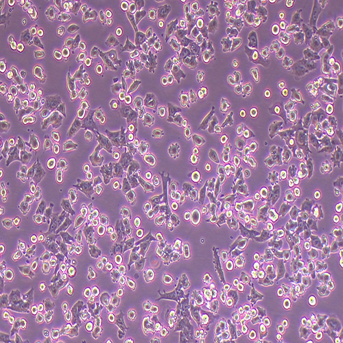 hepa1-6小鼠肝癌细胞