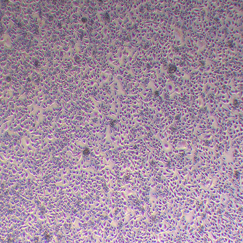 MFC小鼠胃癌细胞（种属鉴定正确）