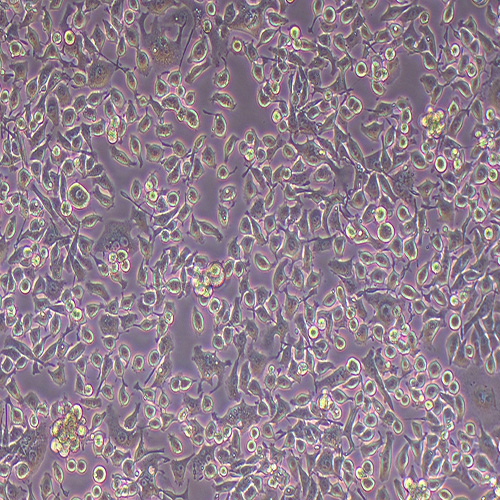 MFC小鼠胃癌细胞（种属鉴定正确）