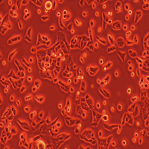 RENCA小鼠肾癌细胞