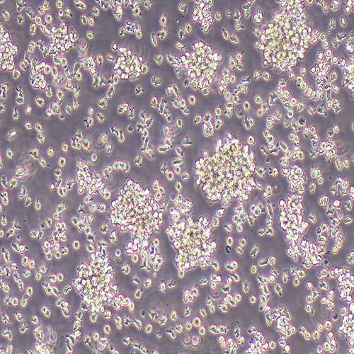 YAC-1小鼠淋巴瘤细胞