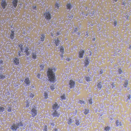 YAC-1小鼠淋巴瘤细胞