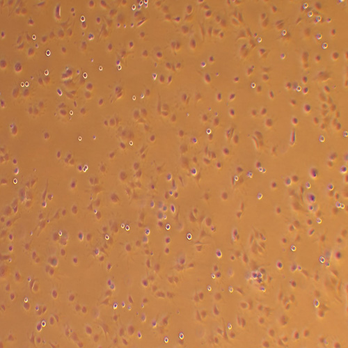 小鼠主动脉血管平滑肌细胞（永生化）