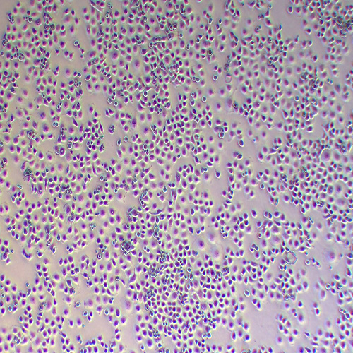 5-8F人高转移鼻咽癌细胞系（STR鉴定正确）