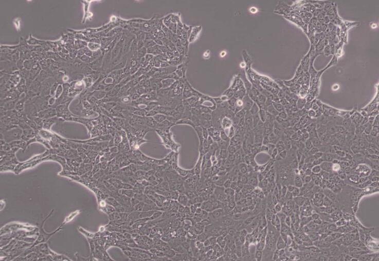 CFPAC-1（人胰腺癌细胞）