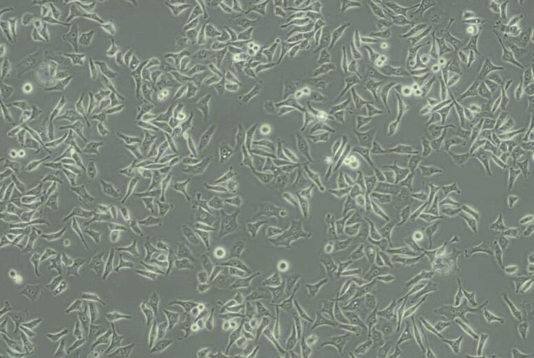 CNE（人鼻咽癌细胞）