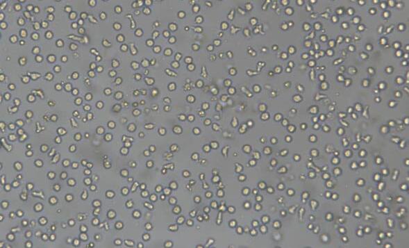 CoC1/DDP（人卵巢癌细胞CoC1顺铂耐药亚株）