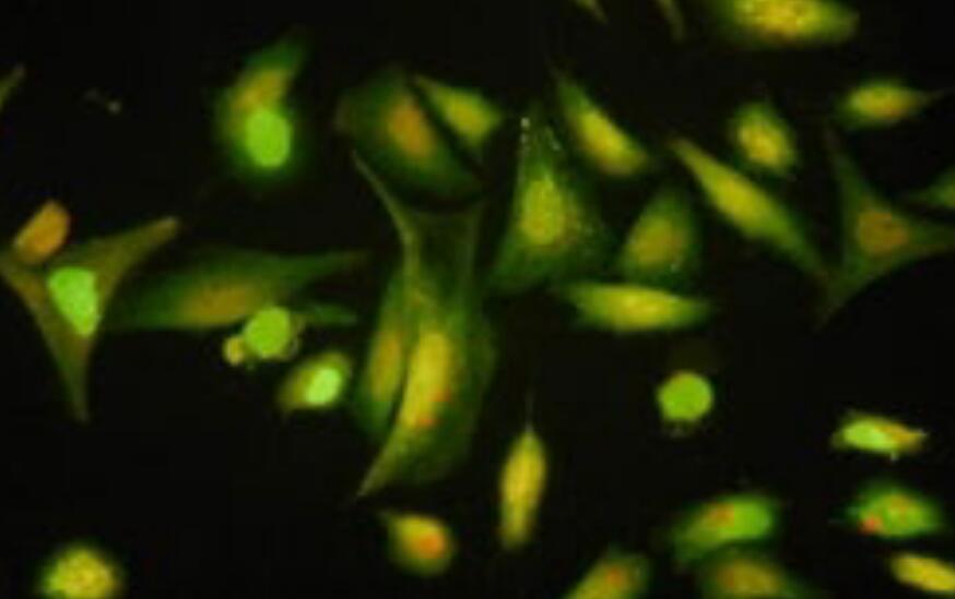 H4（人脑神经胶质瘤细胞）