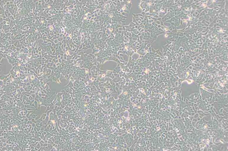 HCT 116（人结肠癌细胞）