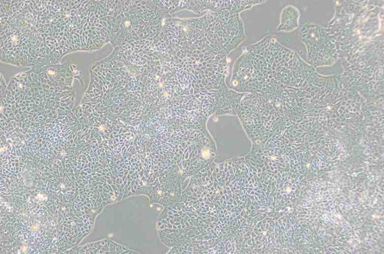 HCT-8 [HRT-18]（人回盲肠癌细胞）