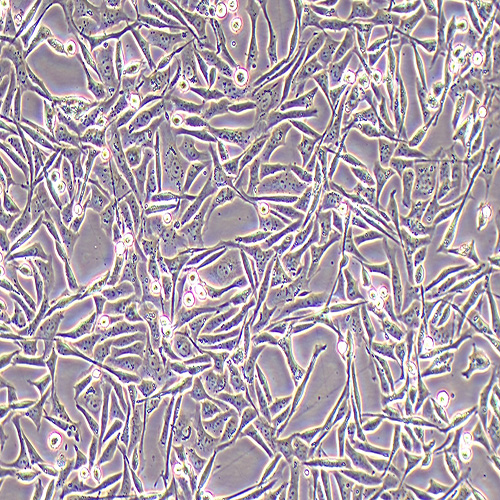 A-204人横纹肌肉瘤细胞（STR鉴定正确）