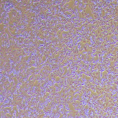 A-204人横纹肌肉瘤细胞（STR鉴定正确）