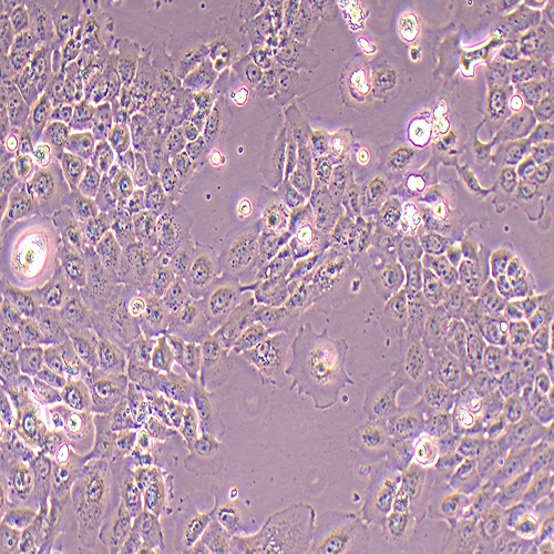 A431人皮肤鳞癌细胞（STR鉴定正确）