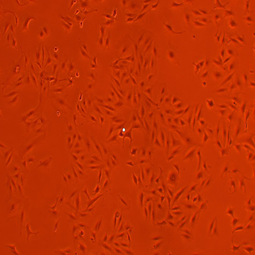 A875人黑色素瘤细胞（STR鉴定正确）