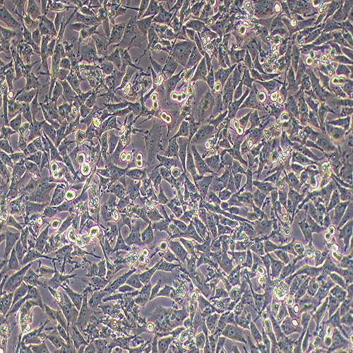 A2058人皮肤癌细胞（STR鉴定正确）