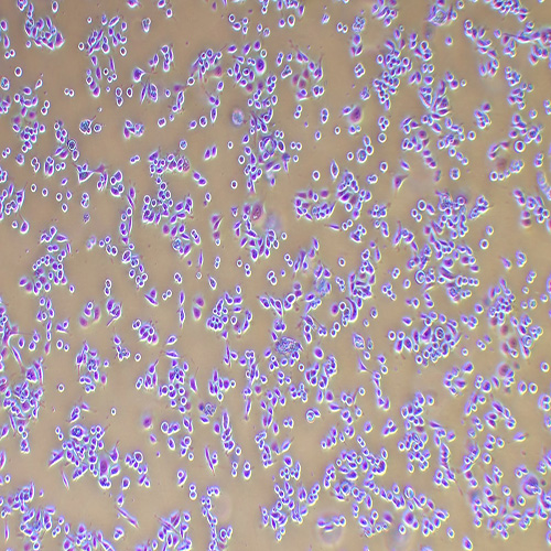AGS人胃腺癌细胞（STR鉴定正确）