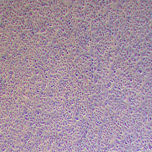 ARPE-19人视网膜色素上皮细胞（STR鉴定正确）