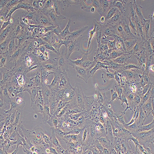 BEAS-2B人支气管上皮样细胞（STR鉴定正确）