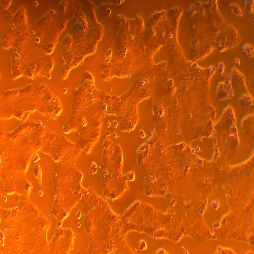 bewo人绒毛膜肿瘤细胞(STR鉴定正确)