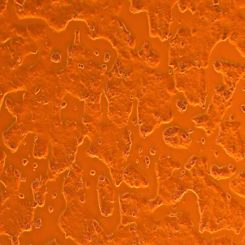 bewo人绒毛膜肿瘤细胞(STR鉴定正确)