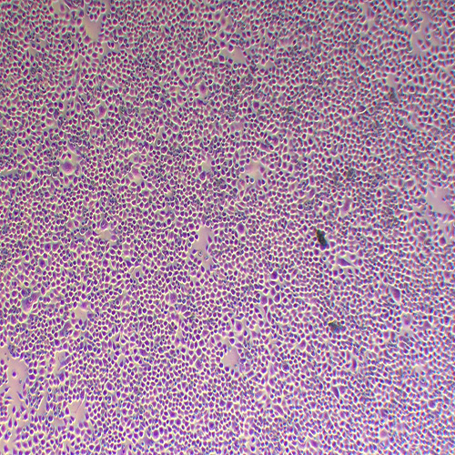 BGC-823人胃腺癌细胞(低分化)