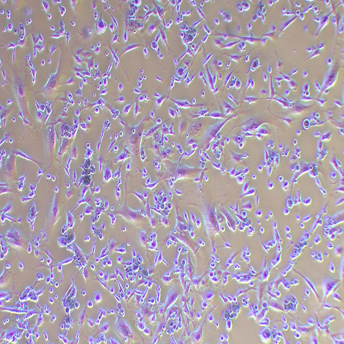 BT-549人乳腺管癌细胞（STR鉴定正确）