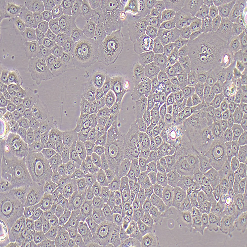 BxPC-3人原位胰腺腺癌细胞（STR鉴定正确）