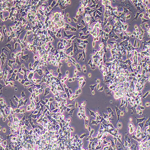 C666-1人鼻咽癌细胞株（STR鉴定正确）