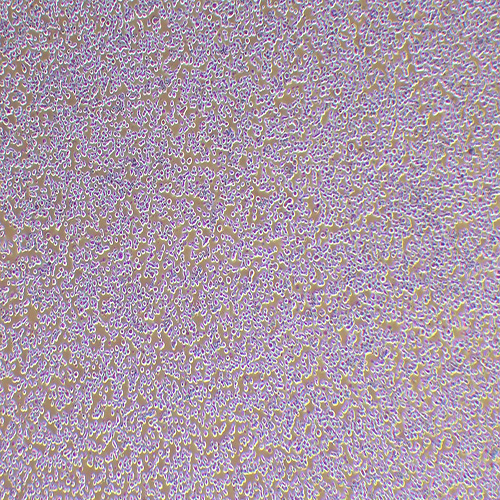 CA46人Burkitt's淋巴瘤细胞（STR鉴定正确）