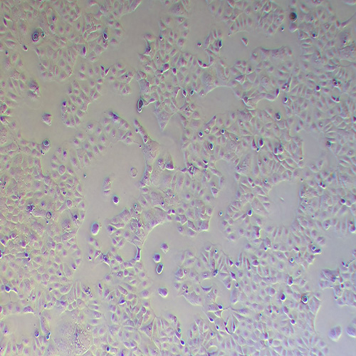 Caco-2人结直肠腺癌细胞（STR鉴定正确）