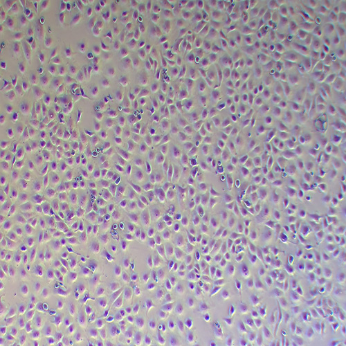 Caki-2人肾透明细胞癌细胞（STR鉴定正确）