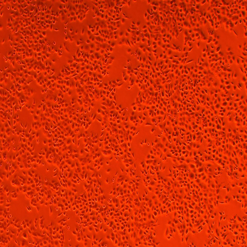 CAL-27人舌鳞癌细胞（STR鉴定正确）