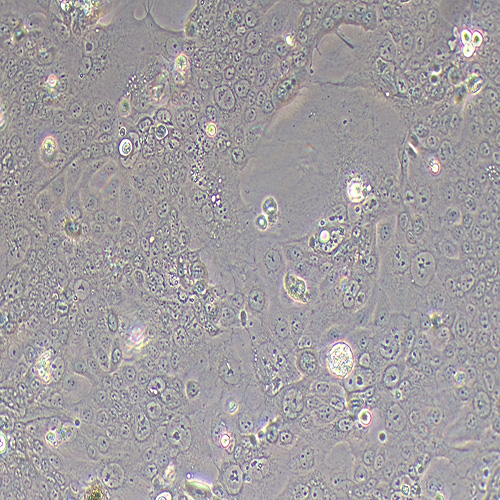 Capan-2人胰腺癌细胞