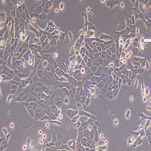 CFPAC-1人胰腺癌细胞