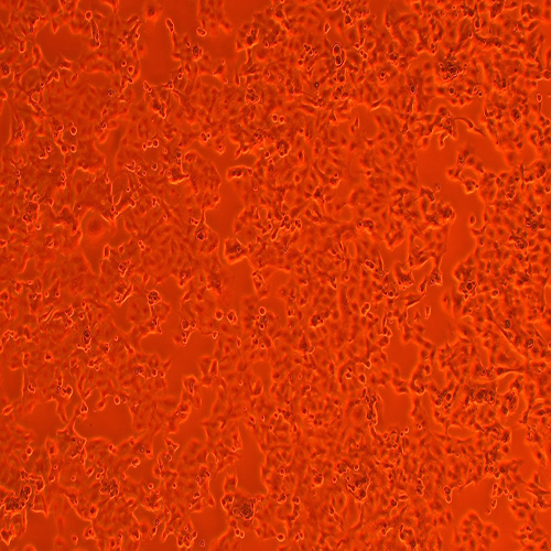 CNE2人鼻咽癌细胞（STR鉴定正确）