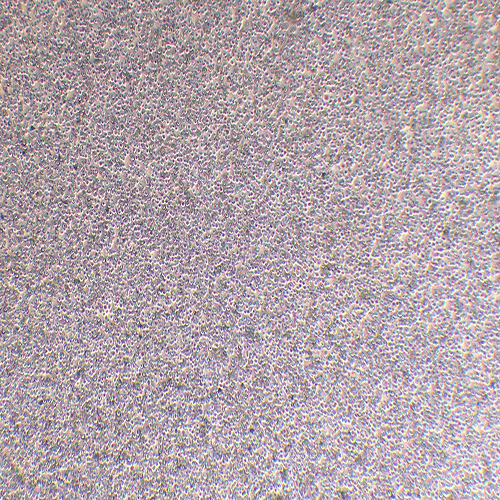 CoC1人卵巢癌细胞（STR鉴定正确）