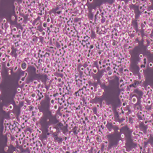 COLO 320DM人结直肠腺癌细胞