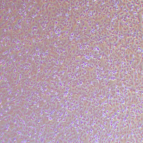 ECC-1人子宫内膜癌细胞（STR鉴定正