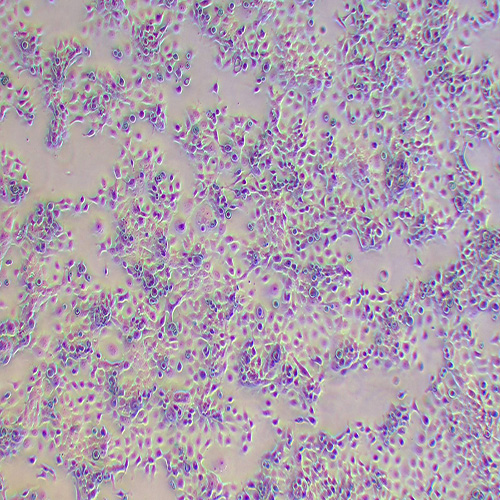 FaDu人咽鳞癌细胞 （STR鉴定正确）